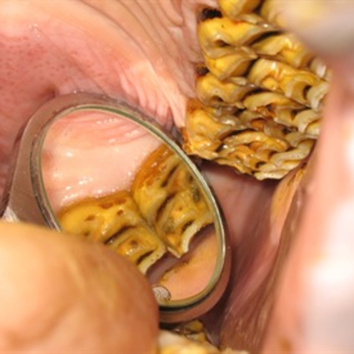 Dental-examination-A-buccal-ulcer-due-to-an-ovetrgrowth-in-a-caudal-maxillary-cheek-tooth___DocSlideshowPics