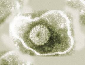 microscopic view of equine herpes virus (EHV-1)